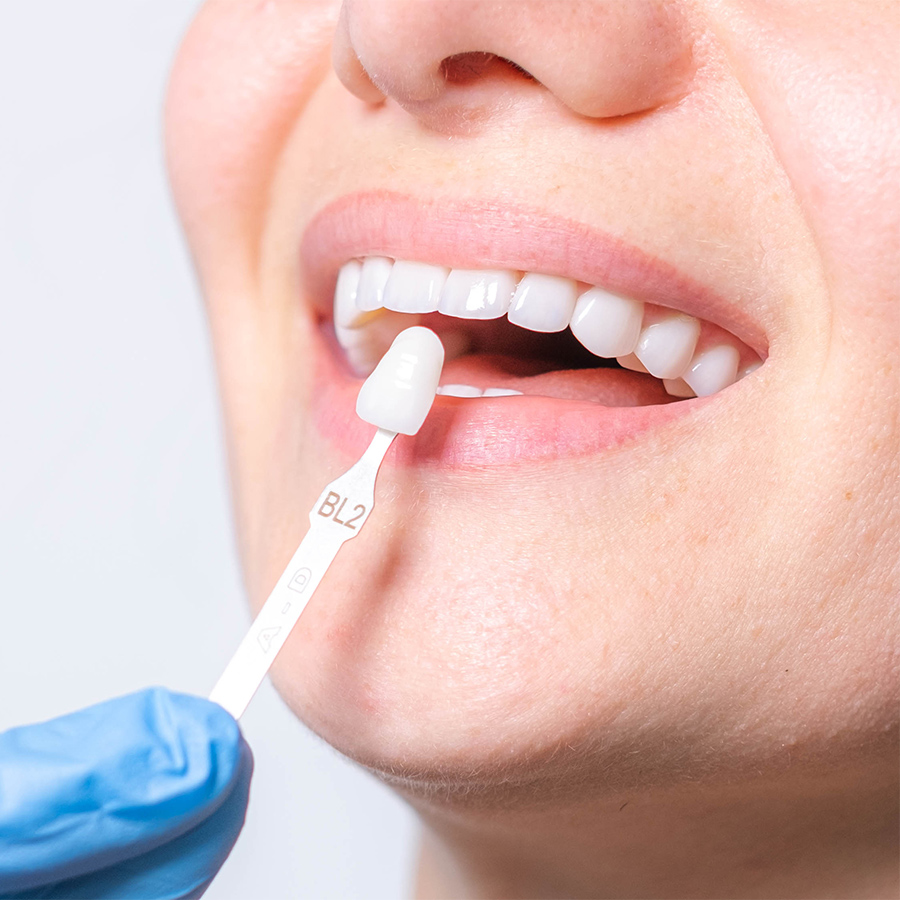 Frau mit strahlend weißen Zähnen