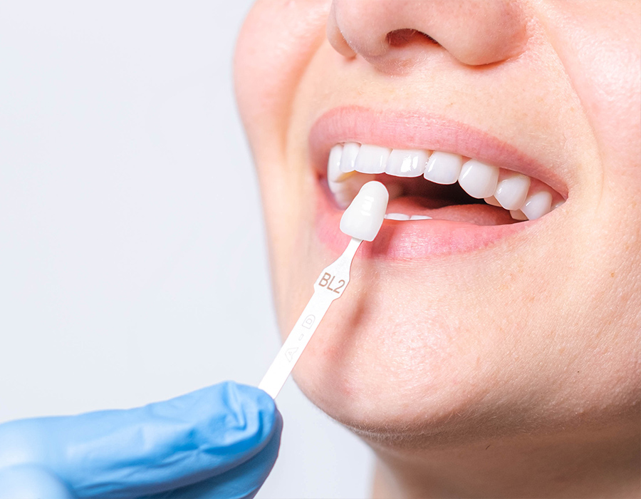 Ästhetische Zahnmedizin Düsseldorf Frau mit strahlend weißen Zähnen