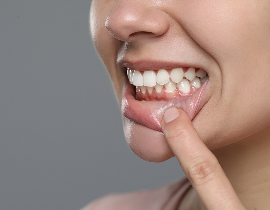 Parodontologie Düsseldorf Frau mit strahlend weißen Zähnen